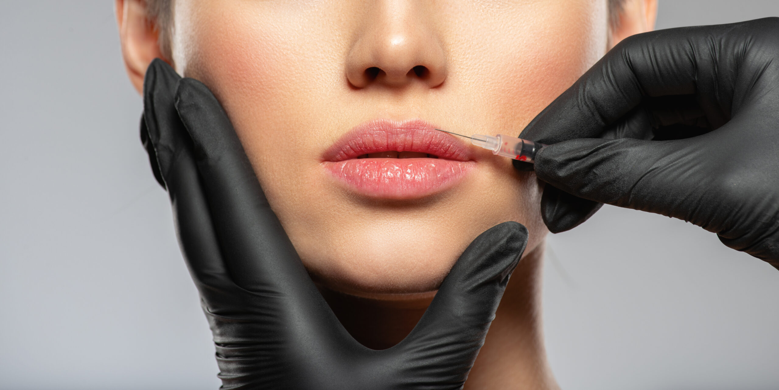 caucasian woman getting botox cosmetic injection i 2022 02 07 23 55 49 utc scaled