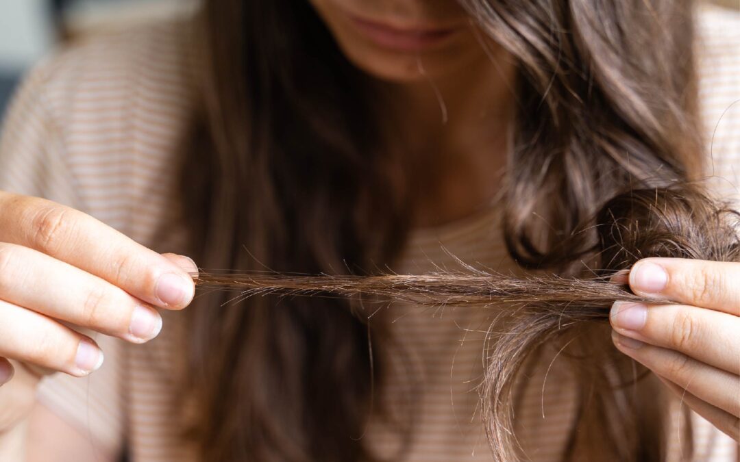 Tricorrexis Nudosa: causas, tratamientos y cuidados para un cabello saludable